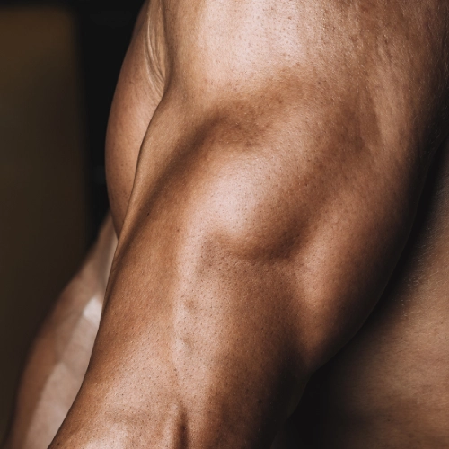 Plano detallado de musculación en brazo